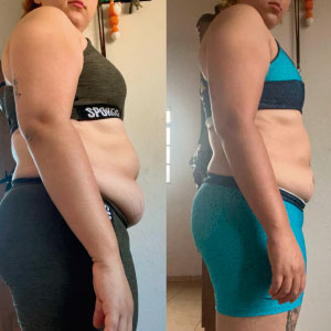 antes-depois-novos-1