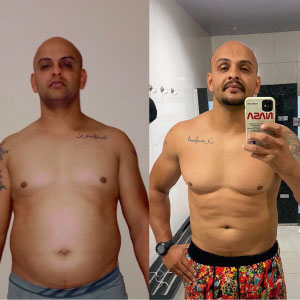 antes-depois-novos-15