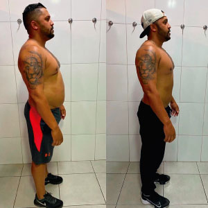 antes-depois-novos-16